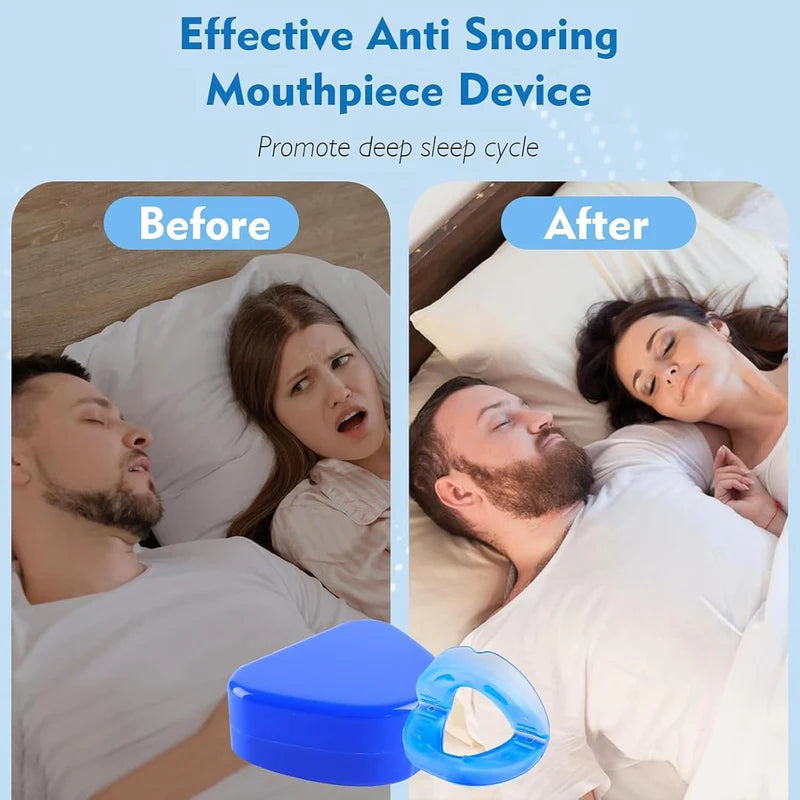 Anti Snore Mouth-Piece